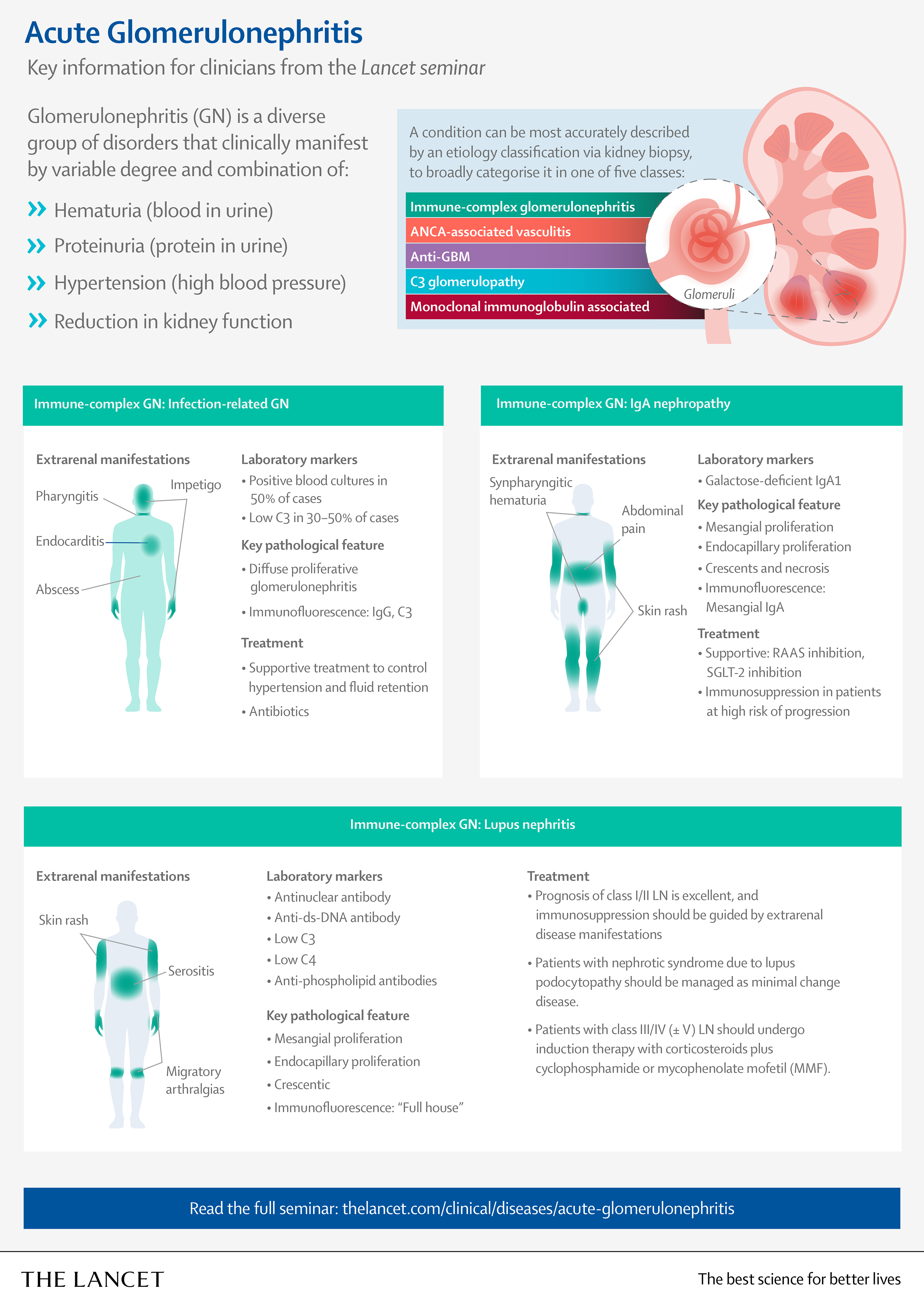 Infographic about Glomerulonephritis diagnosis, page 1