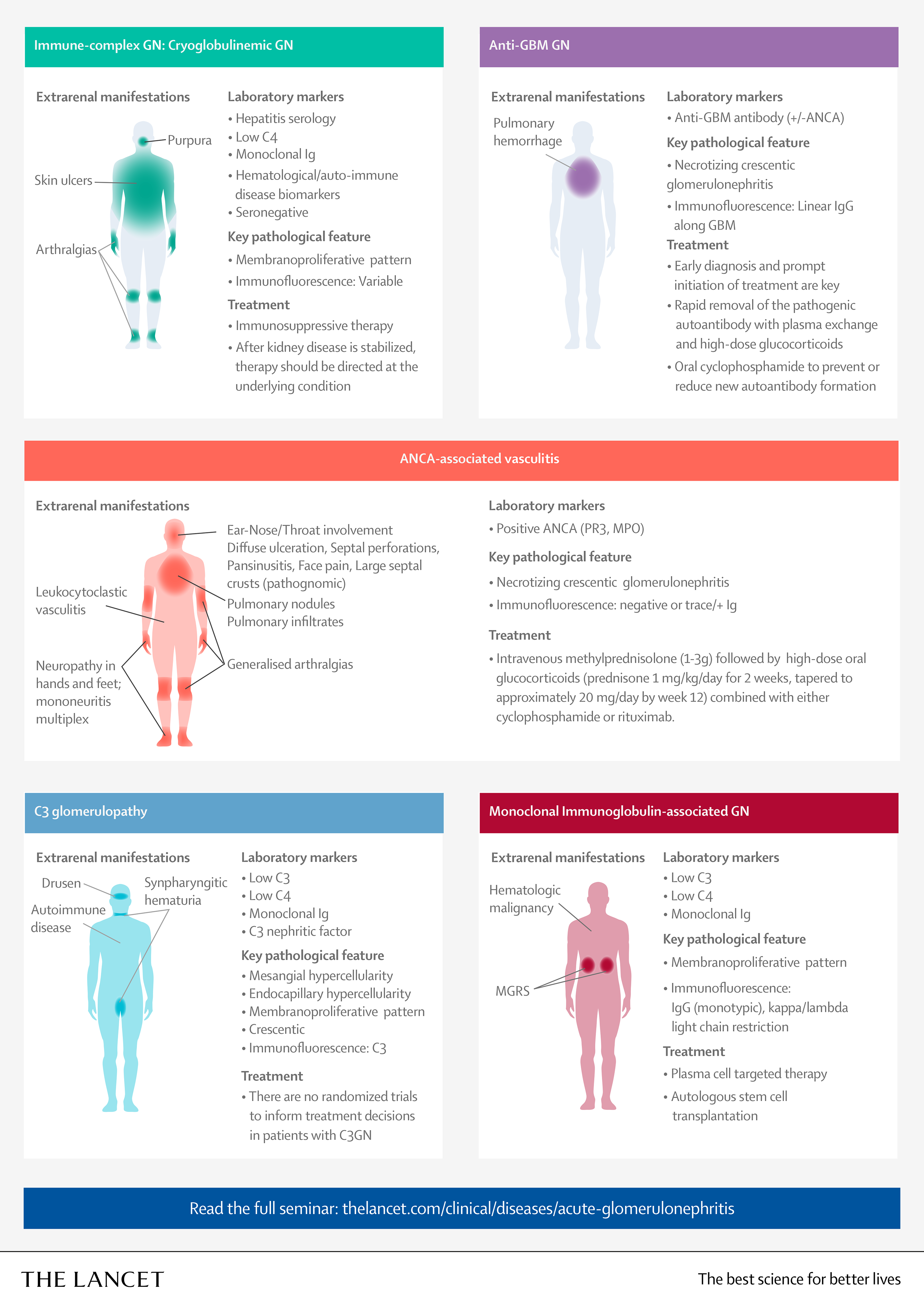 Infographic about Glomerulonephritis diagnosis, page 2